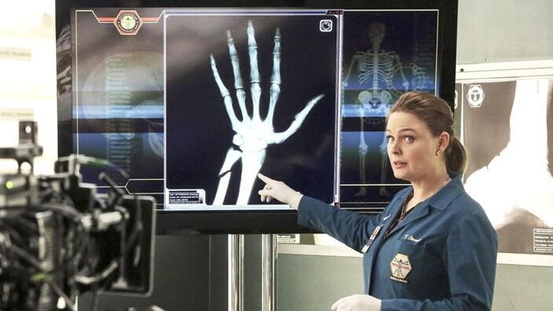 Vignette du programme télé Bones
