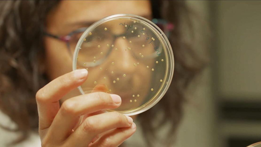 Vignette du programme télé Ces microbes qui vous veulent du bien