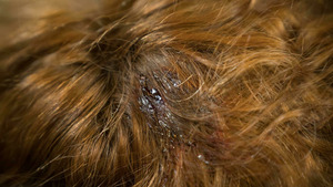 Vignette du programme télé Candice Renoir (Qui sème l'injustice moissonne le malheur) S8 (9/10)