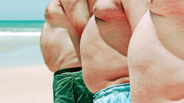 Vignette du programme télé Obésité : comprendre et traiter